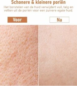 Fesio Lichaamsborstel Met Lange Steel - Dubbelzijdig - Dry Brushing Rugborstel/Badborstel/Doucheborstel/Huidborstel - 43 Cm -Verzorgingsproducten Verkoop 1080x1200 1