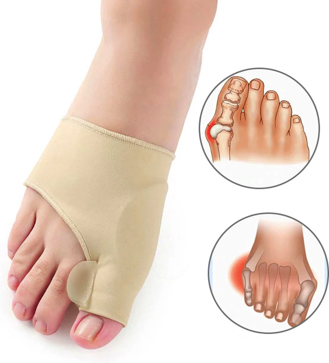 Merkloos Hallux Valgus Teenbeschermers - 2 Stuks - Teenspreiders 5 Merkloos Hallux Valgus Teenbeschermers - 2 Stuks - Teenspreiders - Afbeelding 3
