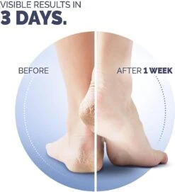 Scholl Klovenzalf - K+ Creme - Voor Hielkloven En Ruwe, Droge Huid 15 Scholl Klovenzalf - K+ Creme - Voor Hielkloven En Ruwe, Droge Huid -Verzorgingsproducten Verkoop 1094x1200 1