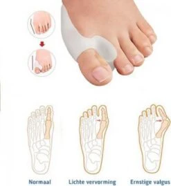 MYCARE+ Teencorrector - Wasbare Teencorrector - Gel-laag - 1 Paar - Pijn Verlichtend -Verzorgingsproducten Verkoop 1102x1200