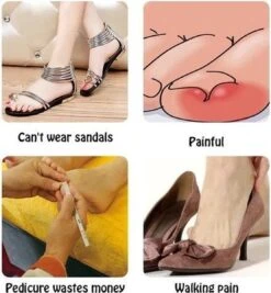 Merkloos Ingegroeide Teennagel Corrector -Verzorgingsproducten Verkoop 1111x1200