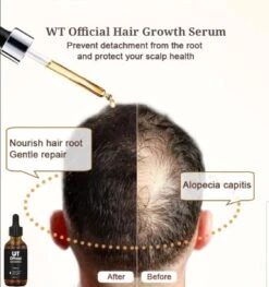 Merkloos Haarserum - Haargroei Stimulator - Tegen Haaruitval - Baardgroeimiddel 15 Merkloos Haarserum - Haargroei Stimulator - Tegen Haaruitval - Baardgroeimiddel -Verzorgingsproducten Verkoop 1125x1200 12