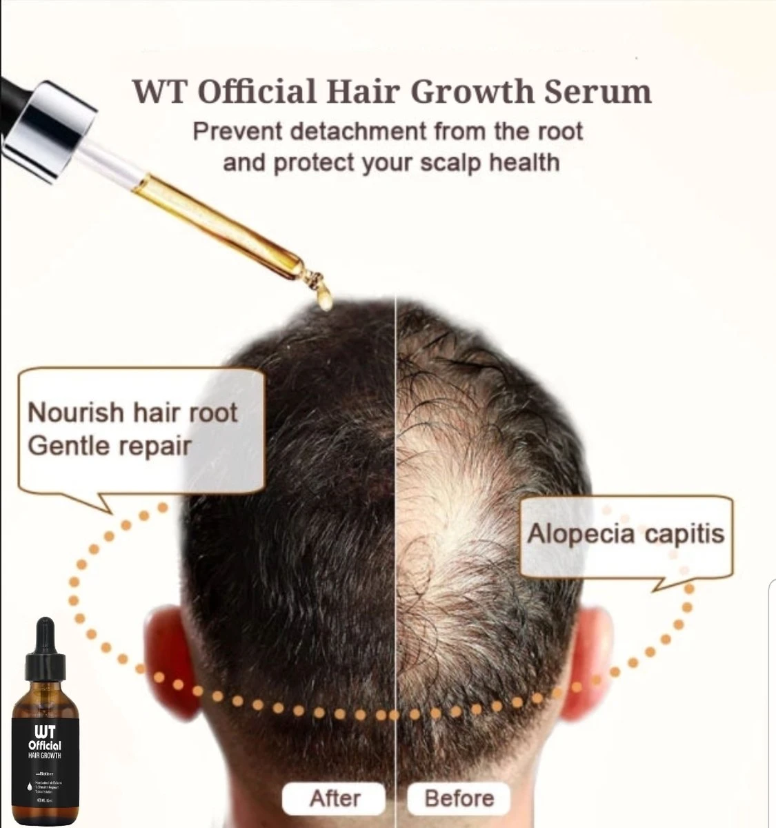 Merkloos Haarserum - Haargroei Stimulator - Tegen Haaruitval - Baardgroeimiddel 6 Merkloos Haarserum - Haargroei Stimulator - Tegen Haaruitval - Baardgroeimiddel - Afbeelding 4