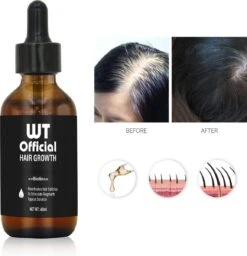 Merkloos Haarserum - Haargroei Stimulator - Tegen Haaruitval - Baardgroeimiddel 18 Merkloos Haarserum - Haargroei Stimulator - Tegen Haaruitval - Baardgroeimiddel -Verzorgingsproducten Verkoop 1159x1200 8