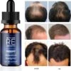 Regrowth | Haarserum - Alternatief Minoxidil 5% - Haargroei Serum - Haargroei Versneller - Haargroei Producten -Verzorgingsproducten Verkoop 1186x1200 4