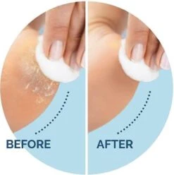 Scholl Velvet Smooth Voetvijl Wet & Dry - Starter - 1 Stuk 9 Scholl Velvet Smooth Voetvijl Wet & Dry - Starter - 1 Stuk -Verzorgingsproducten Verkoop 1196x1200