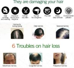 Haarserum 7days | Haarkuur 7daags | Haaruitval Bestrijden | Gember Extracten Voor Stimuleren Haargroei | Haar Olie | Bewezen Formule 14 Haarserum 7days | Haarkuur 7daags | Haaruitval Bestrijden | Gember Extracten Voor Stimuleren Haargroei | Haar Olie | Bewezen Formule -Verzorgingsproducten Verkoop 1200x1100 4