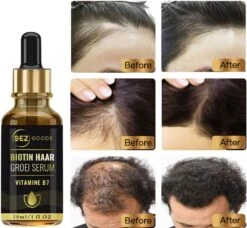 Haarserum - Haargroei Stimulator - Tegen Haaruitval - Haargroei Serum - Baardgroeimiddel - Baardgroei Olie - Alternatief Voor Minoxidil 5% -Verzorgingsproducten Verkoop 1200x1110 4