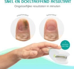 Anti Schimmelnagel Zelf-laserapparaat Incl. Pedicure Set -Verzorgingsproducten Verkoop 1200x1120