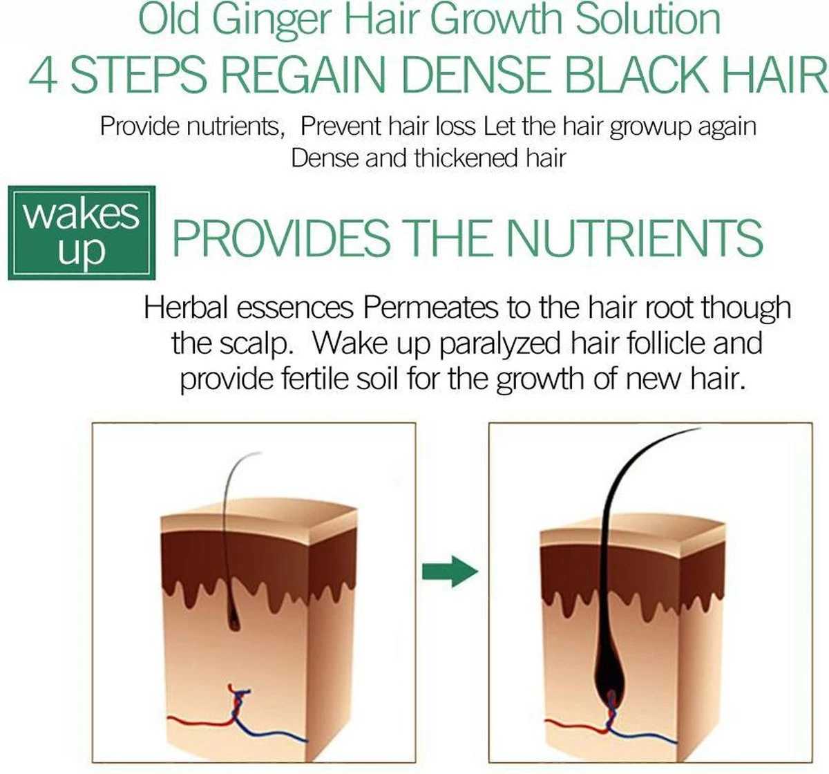 Haarserum 7days | Haarkuur 7daags | Haaruitval Bestrijden | Gember Extracten Voor Stimuleren Haargroei | Haar Olie | Bewezen Formule 7 Haarserum 7days | Haarkuur 7daags | Haaruitval Bestrijden | Gember Extracten Voor Stimuleren Haargroei | Haar Olie | Bewezen Formule - Afbeelding 5