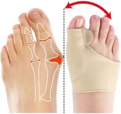 Hallux Valgus - Teenspreider - Teencorrector - Hallux Valgus Grote Teencorrector - Sok 2 Stuks -Verzorgingsproducten Verkoop 1200x1133