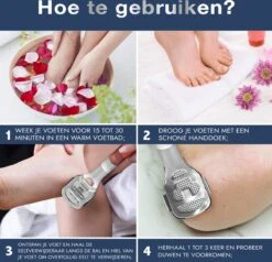 Pedicureset Professioneel - Pedicure Eeltmesjes - Eelt Verwijderaar Pedicure Set - Eeltverwijderaar Voetvijl - Eeltschraper - Eeltschaaf - Eeltrasp -Verzorgingsproducten Verkoop 1200x1157 1