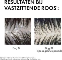 Vichy Dercos Anti-roos Shampoo Voor Normaal Tot Vet Haar - 2x200ml -Verzorgingsproducten Verkoop 1200x1159 5