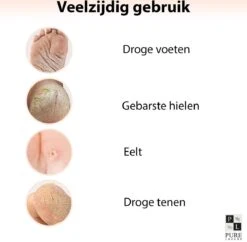 PureLuxure Voetmasker - Voetverzorging - Eeltsokken - Eelt Verwijderaar - Voetenmasker - Peel Off Masker - 1 Paar (2 Stuks) -Verzorgingsproducten Verkoop 1200x1174 1