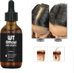 Merkloos Haarserum - Haargroei Stimulator - Tegen Haaruitval - Baardgroeimiddel 13 Merkloos Haarserum - Haargroei Stimulator - Tegen Haaruitval - Baardgroeimiddel -Verzorgingsproducten Verkoop 1200x1185 3