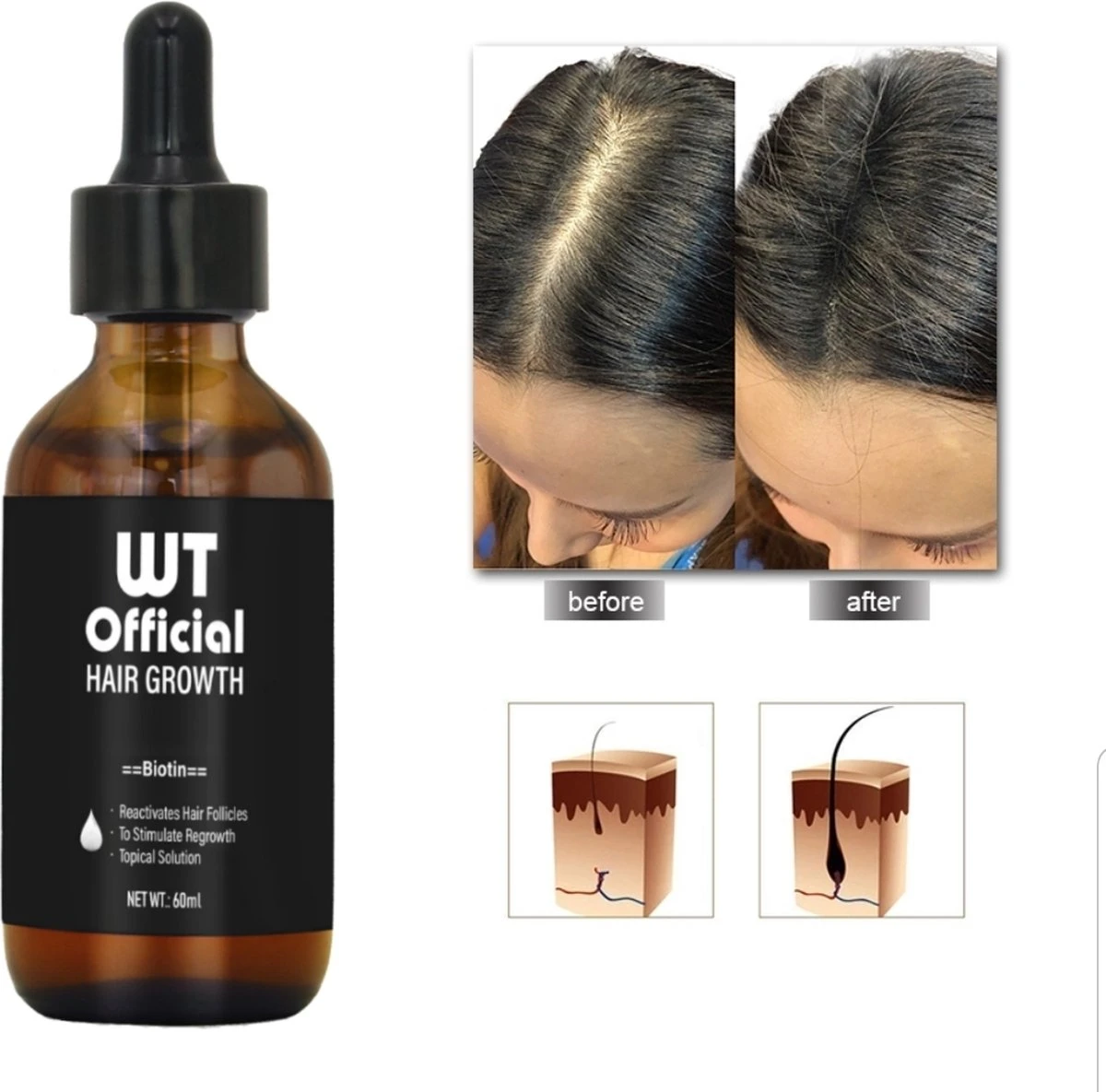 Merkloos Haarserum - Haargroei Stimulator - Tegen Haaruitval - Baardgroeimiddel 4 Merkloos Haarserum - Haargroei Stimulator - Tegen Haaruitval - Baardgroeimiddel - Afbeelding 2