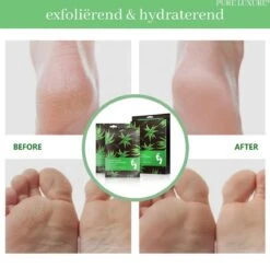 PureLuxure Voetmasker - Voetverzorging - Eeltsokken - Eelt Verwijderaar - Voetenmasker - Peel Off Masker - 1 Paar (2 Stuks) -Verzorgingsproducten Verkoop 1200x1191