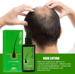 Green Wealth Neo Hair Lotion - Neo Hair Lotion Origineel - Original - Anti Haaruitval - Haargroeiproducten -Verzorgingsproducten Verkoop 1200x1191 9