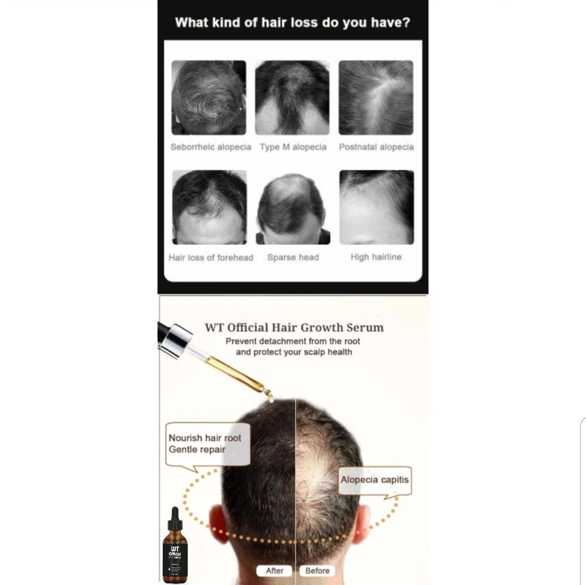 Merkloos Haarserum - Haargroei Stimulator - Tegen Haaruitval - Baardgroeimiddel 7 Merkloos Haarserum - Haargroei Stimulator - Tegen Haaruitval - Baardgroeimiddel - Afbeelding 5