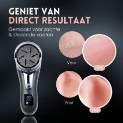 Beeperfect® Elektrische Eeltverwijderaar Met Stofzuigsysteem - Voetvijl - Eeltvijl - IPX7 Waterdicht - Gratis Pedicure Set - Zwart -Verzorgingsproducten Verkoop 1200x1200 123