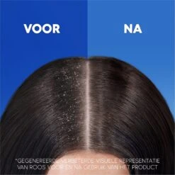 Head & Shoulders Jeukende Hoofdhuid 2in1 - Anti-roos Shampoo & Conditioner - Tot 100% Roosvrij - Voordeelverpakking 6 X 270 Ml 15 Head & Shoulders Jeukende Hoofdhuid 2in1 - Anti-roos Shampoo & Conditioner - Tot 100% Roosvrij - Voordeelverpakking 6 X 270 Ml -Verzorgingsproducten Verkoop 1200x1200 1290