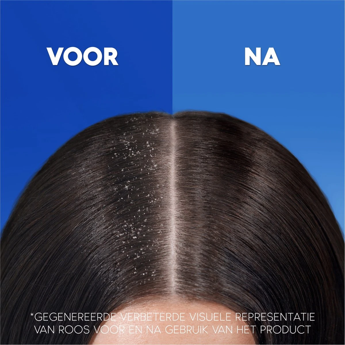 Head & Shoulders Apple Fresh - Anti-roos Shampoo - Tot 100% Roosvrij - Voordeelverpakking 6 X 285 Ml 13 Head & Shoulders Apple Fresh - Anti-roos Shampoo - Tot 100% Roosvrij - Voordeelverpakking 6 X 285 Ml - Afbeelding 11