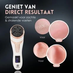 Beeperfect® Elektrische Eeltverwijderaar Met Stofzuigsysteem - Voetvijl - Eeltvijl - IPX7 Waterdicht - Gratis Pedicure Set -Verzorgingsproducten Verkoop 1200x1200 138