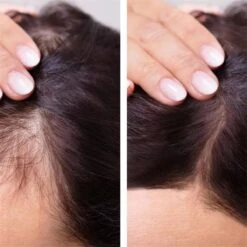 Hair Growth - Essential Oil - Natural - Anti Hair Loss - Fast Grow - Treatment - Men - Woman - Cadeau - -Verzorgingsproducten Verkoop 1200x1200 1447