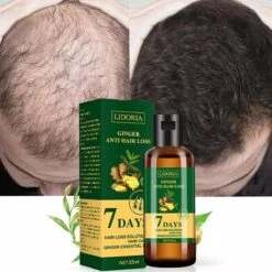 Hair Growth - Essential Oil - Natural - Anti Hair Loss - Fast Grow - Treatment - Men - Woman - Cadeau - -Verzorgingsproducten Verkoop 1200x1200 1448