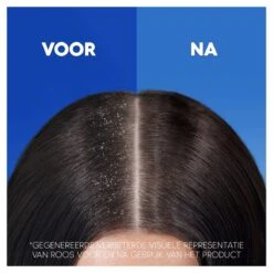 Head & Shoulders Intense Hydration - Anti-roos - Conditioner - Verhoogde Anti-roos Bescherming - 6 X 220ml -Verzorgingsproducten Verkoop 1200x1200 1458