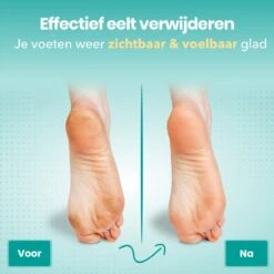 FreshDragon Elektrische Eelt Verwijderaar - Voetvijl - Inclusief 3 Rollers - Oplaadbaar 16 FreshDragon Elektrische Eelt Verwijderaar - Voetvijl - Inclusief 3 Rollers - Oplaadbaar -Verzorgingsproducten Verkoop 1200x1200 152