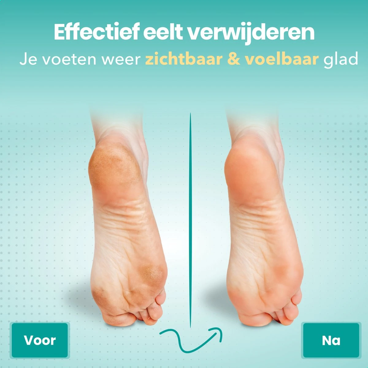 FreshDragon Elektrische Eelt Verwijderaar - Voetvijl - Inclusief 3 Rollers - Oplaadbaar 8 FreshDragon Elektrische Eelt Verwijderaar - Voetvijl - Inclusief 3 Rollers - Oplaadbaar - Afbeelding 6