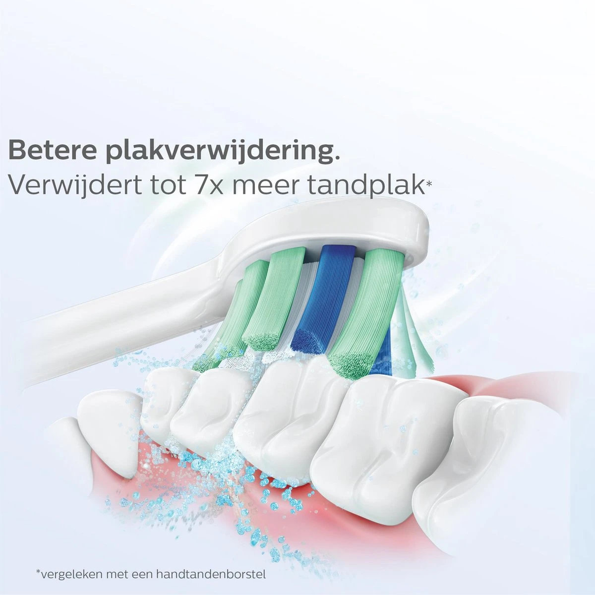 Philips Sonicare C2 Optimal Plaque Defence HX9022/10 - Opzetborstels - 2 Stuks 13 Philips Sonicare C2 Optimal Plaque Defence HX9022/10 - Opzetborstels - 2 Stuks - Afbeelding 11