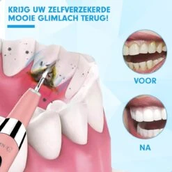 DEN-T® PRO U500 - Elektrische Sonische Tandsteen Verwijderaar - Roze 20 DEN-T® PRO U500 - Elektrische Sonische Tandsteen Verwijderaar - Roze -Verzorgingsproducten Verkoop 1200x1200 1606