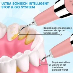 DEN-T® PRO U500 - Elektrische Sonische Tandsteen Verwijderaar - Roze 22 DEN-T® PRO U500 - Elektrische Sonische Tandsteen Verwijderaar - Roze -Verzorgingsproducten Verkoop 1200x1200 1608