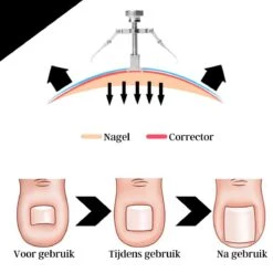 7-delige Pedicure En Manicure Set - Nagelknipper - Pedicureset - Nagelvijl - Nageltang - Kalknagel - Teennagelknipper -Verzorgingsproducten Verkoop 1200x1200 366