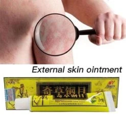 Psoriasis/exzeem Chineese Creme -Verzorgingsproducten Verkoop 1200x1200 466