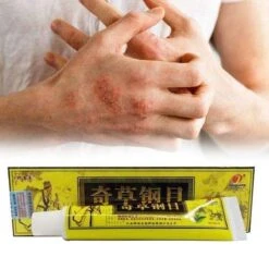 Psoriasis/exzeem Chineese Creme -Verzorgingsproducten Verkoop 1200x1200 467