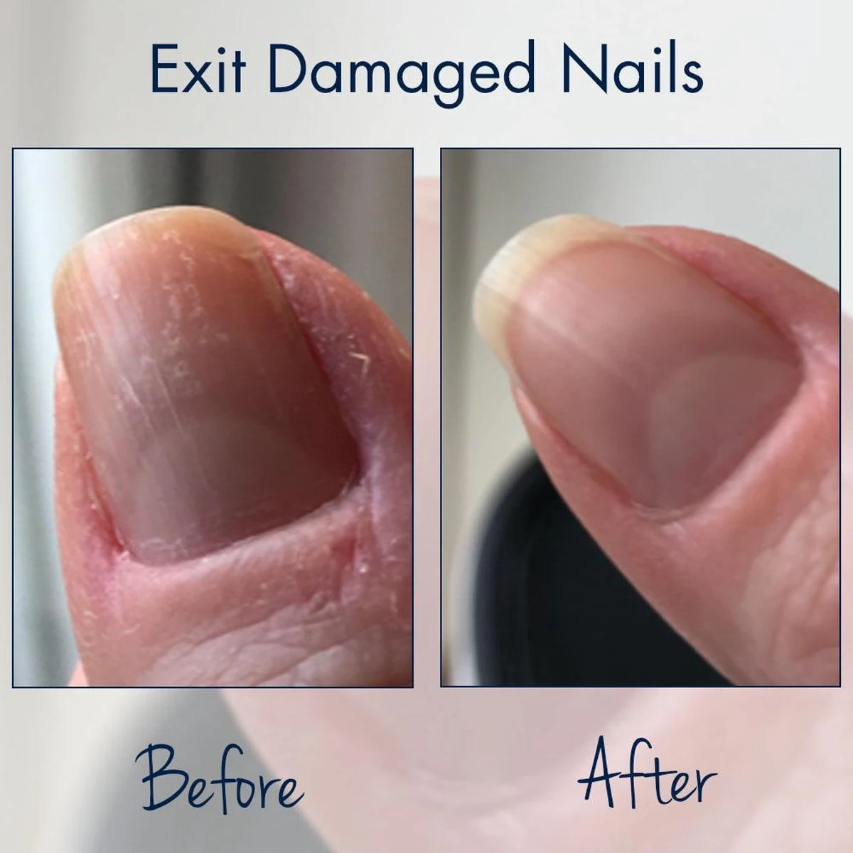 Herome Exit Damaged Nails Nagelolie – Amandelolie Met Vitamines En Mineralen Verbetert En Herstelt De Nagels - 7 Ml. 4 Herome Exit Damaged Nails Nagelolie – Amandelolie Met Vitamines En Mineralen Verbetert En Herstelt De Nagels - 7 Ml. - Afbeelding 2