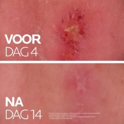 La Roche-Posay Cicaplast Balsem B5+ - 100ml - Voor Gevoelige Huid -Verzorgingsproducten Verkoop 1200x1200 586