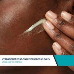 CeraVe Resurfacing Retinol Serum - 30ml - Voor Onzuivere Huid Met Neiging Tot Acne -Verzorgingsproducten Verkoop 1200x1200 589