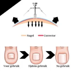 7-Delige Pedicure Set - Nagelverzorging - Nagelset - Ingegroeide Teennagel - Nagelknipper - Nail Clippers - Ingrown Toenail -Verzorgingsproducten Verkoop 1200x1200 9