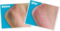 O'Keeffe's - Voetencreme - Voor Gezonde Voeten - Potje 96 Gram -Verzorgingsproducten Verkoop 1200x622