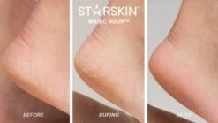 STARSKIN Exfoliating Magic Hour Eeltsokken Voet Masker - Eelt Verwijderaar - Baby Foot Peel Mask 11 STARSKIN Exfoliating Magic Hour Eeltsokken Voet Masker - Eelt Verwijderaar - Baby Foot Peel Mask -Verzorgingsproducten Verkoop 1200x675 3