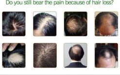 Haarserum 7days | Haarkuur 7daags | Haaruitval Bestrijden | Gember Extracten Voor Stimuleren Haargroei | Haar Olie | Bewezen Formule 13 Haarserum 7days | Haarkuur 7daags | Haaruitval Bestrijden | Gember Extracten Voor Stimuleren Haargroei | Haar Olie | Bewezen Formule -Verzorgingsproducten Verkoop 1200x747 2