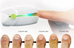 Anti Schimmelnagel Kalknagel Laserapparaat Om Zelf Te Behandelen, Veilig, Effectief, Snel En Pijnloos, Koude Laser Behandeling Voor Thuisgebruik, Voor Tenen En Vingers. Oplaadbaar. -Verzorgingsproducten Verkoop 1200x774