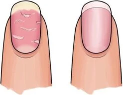 Herome 3 In 1 Manicure Nagelverzorging Set – Beschadigde Nagels – Nagelriemolie, Nagelriemcrème En Nagelverharder -Verzorgingsproducten Verkoop 1200x925