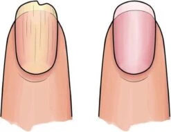 Herome 3 In 1 Manicure Nagelverzorging Set (Nail Essentials Geel) – Nagelset Voor Droge En Geribbelde Nagels – Base Coat, Vijl En Voedende Nagelolie – Voor Egale En Flexibele Nagels -Verzorgingsproducten Verkoop 1200x926