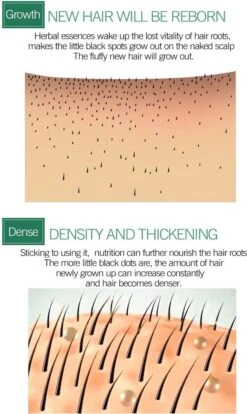 Haarserum 7days | Haarkuur 7daags | Haaruitval Bestrijden | Gember Extracten Voor Stimuleren Haargroei | Haar Olie | Bewezen Formule 19 Haarserum 7days | Haarkuur 7daags | Haaruitval Bestrijden | Gember Extracten Voor Stimuleren Haargroei | Haar Olie | Bewezen Formule -Verzorgingsproducten Verkoop 716x1200