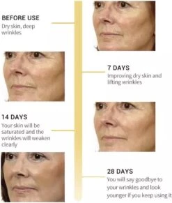 Gezicht Collageen | Lifting Verstevigende Serum | Rimpel Verwijderaar | Anti Aging Care - Retinol Firming -Verzorgingsproducten Verkoop 1020x1200